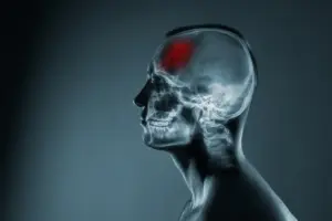 Understanding Toxic Brain Damage